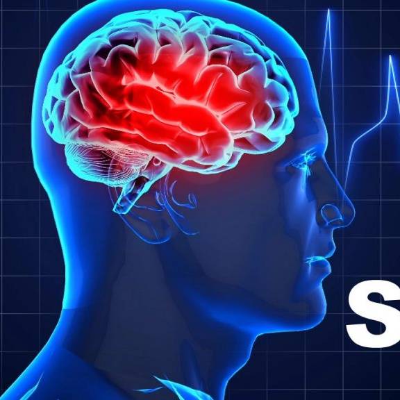 Stroke Research Symposium